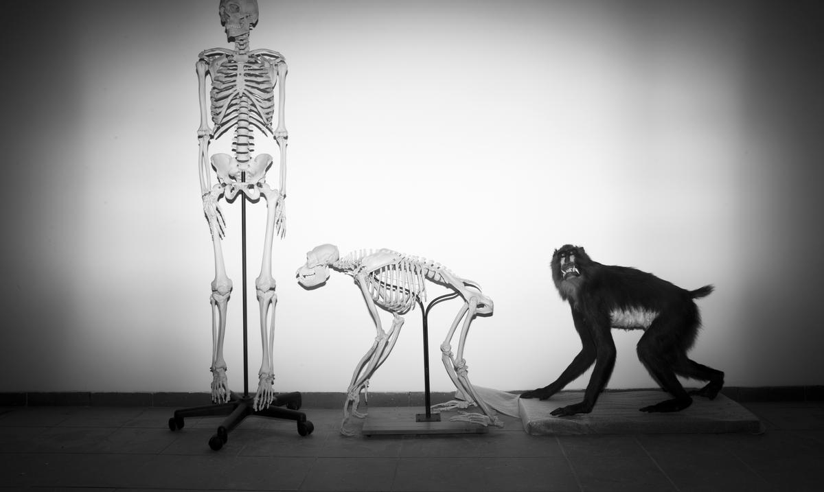 Our oldest animal ancestors had tails.  Why not us?